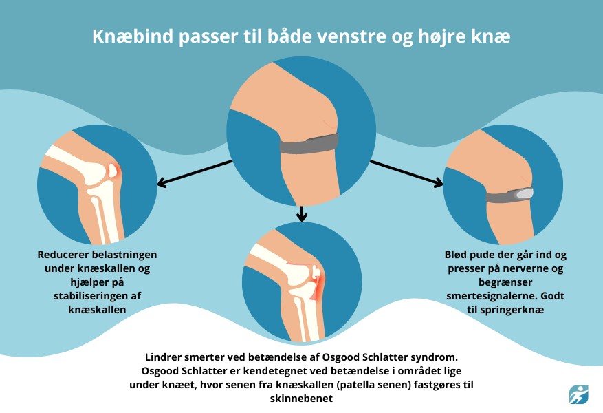infografik til Schlatter knæ