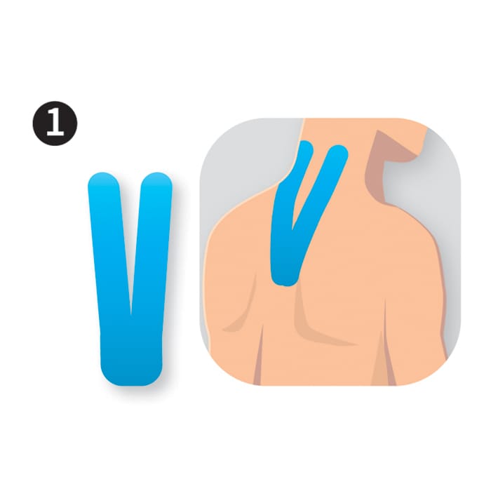 Kinesiologytape Precut - Nakke (8 pak) 2 Kinesiologytape Precut - Nakke (8 pak) - Billede 2