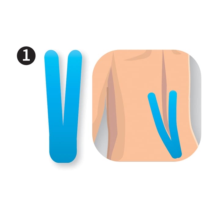 Kinesiologytape Precut - Ryg (8 pak) 2 Kinesiologytape Precut - Ryg (8 pak) - Billede 2