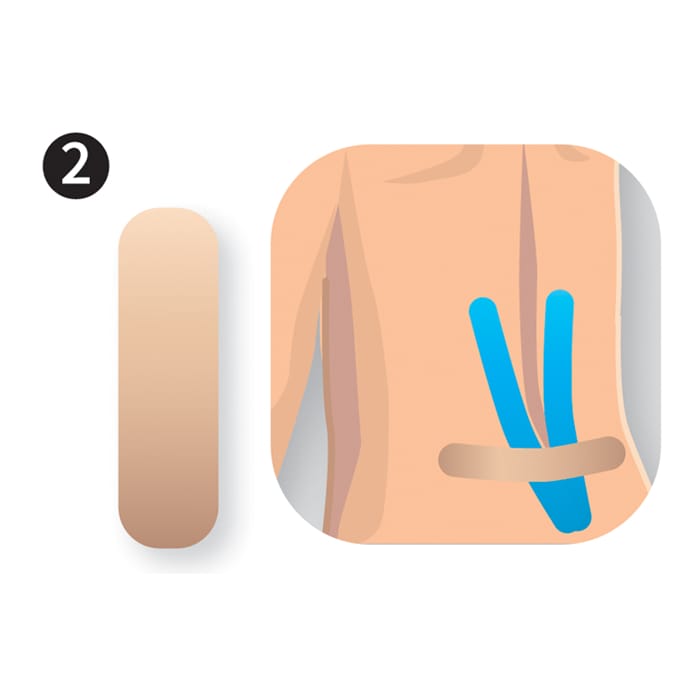 Kinesiologytape Precut - Ryg (8 pak) 3 Kinesiologytape Precut - Ryg (8 pak) - Billede 3